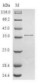 Human Small muscular protein (SMPX) Recombinant Protein, Homo sapiens (Human), E.coli, N-terminal GST-tagged, 36.6 kDa, purity >≥ 90% as determined by SDS-PAGE.