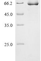 Rat Glutamate receptor ionotropic, NMDA 1 (Grin1), partial Recombinant Protein - BioCrest Sci