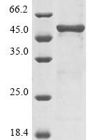 Human Antithrombin-III (SERPINC1) Recombinant Protein, N-His - BioCrest Sci
