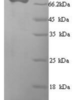 Human Macrophage mannose receptor 1 (MRC1), partial Recombinant Protein, N-His, aa 655–1213, Yeast - BioCrest Sci