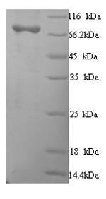 Human Macrophage mannose receptor 1 (MRC1), partial Recombinant Protein, N-His, aa 655–1213, Yeast, Homo sapiens (Human), Yeast, N-terminal 6xHis-tagged, 66.4 kDa, purity >≥ 90% as determined by SDS-PAGE.