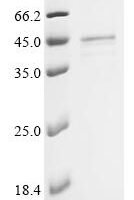 Human Guanine nucleotide-binding protein G(i) subunit alpha-1 (GNAI1) Recombinant Protein, N-Flag/C-8His - BioCrest Sci