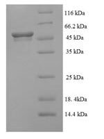 Human Succinate-semialdehyde dehydrogenase, mitochondrial (ALDH5A1) Recombinant Protein, N-His - BioCrest Sci