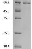 Human Roundabout homolog 3 (ROBO3), partial Recombinant Protein, N-10His/C-Myc - BioCrest Sci