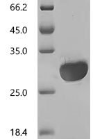 Human Myocilin (MYOC), partial Recombinant Protein, N-His - BioCrest Sci