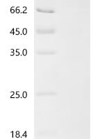 Human Importin subunit beta-1 (KPNB1) Recombinant Protein, C-His, aa 1–876, E.coli - BioCrest Sci