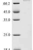 Rat Serine/threonine-protein kinase Chk1 (Chek1) Recombinant Protein, N-His-GST - BioCrest Sci