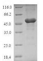 Human TIR domain-containing adapter molecule 2 (TICAM2) Recombinant Protein - BioCrest Sci