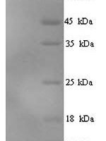 Human Elafin (PI3) Recombinant Protein - BioCrest Sci