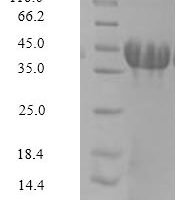 Rat Amphoterin-induced protein 3 (Amigo3) Recombinant Protein - BioCrest Sci