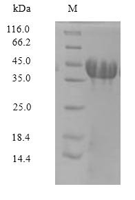 Rat Amphoterin-induced protein 3 (Amigo3) Recombinant Protein, Rattus norvegicus (Rat), Mammalian cell, N-terminal 6xHis-Myc-tagged, 44.4 kDa, purity >≥ 90% as determined by SDS-PAGE.