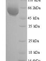 Eschscholzia californica Reticuline oxidase (BBE1) Recombinant Protein - BioCrest Sci