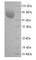 Eschscholzia californica Reticuline oxidase (BBE1) Recombinant Protein, Eschscholzia californica (California poppy), Yeast, N-terminal 6xHis-tagged, 59.4 kDa, purity >≥ 90% as determined by SDS-PAGE.