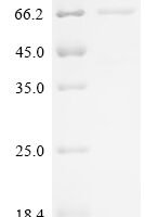Mouse Putative phospholipase B-like 2 (Plbd2) Recombinant Protein, C-10His - BioCrest Sci