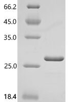 Human Nuclear nucleic acid-binding protein C1D (C1D) Recombinant Protein - BioCrest Sci