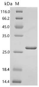 Human Nuclear nucleic acid-binding protein C1D (C1D) Recombinant Protein, E.coli, C-terminal 6xHis-tagged, 22.9 kDa, purity >≥ 90% as determined by SDS-PAGE.