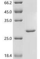 Escherichia coli Bacterioferritin (bfr) Recombinant Protein - BioCrest Sci