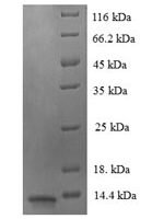Human Luc7-like protein 3 (LUC7L3), partial Recombinant Protein - BioCrest Sci