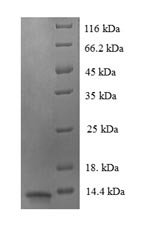 Human Luc7-like protein 3 (LUC7L3), partial Recombinant Protein, Homo sapiens (Human), E.coli, N-terminal 6xHis-tagged, 13.3 kDa, purity >≥ 90% as determined by SDS-PAGE.