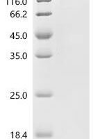 Mouse Integrin alpha-4 (Itga4), partial Recombinant Protein - BioCrest Sci