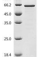 Human TATA-binding protein-associated factor 2N (TAF15), partial Recombinant Protein, C-His, aa 110–592 - BioCrest Sci