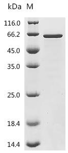 Human TATA-binding protein-associated factor 2N (TAF15), partial Recombinant Protein, C-His, aa 110–592, Homo sapiens (Human), E.coli, C-terminal 6xHis-tagged, 57.1 kDa, purity >≥ 90% as determined by SDS-PAGE.