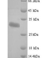 Human Protein delta homolog 1 (DLK1), partial Recombinant Protein, N-His, aa 24–303, Yeast - BioCrest Sci