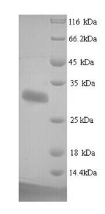 Human Protein delta homolog 1 (DLK1), partial Recombinant Protein, N-His, aa 24–303, Yeast, Homo sapiens (Human), Yeast, N-terminal 6xHis-tagged, 31.8 kDa, purity >≥ 90% as determined by SDS-PAGE.