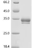 Chicken Hepatocyte growth factor (HGF), partial Recombinant Protein - BioCrest Sci