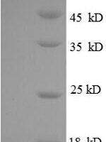 Human C-X-C motif chemokine 3 (CXCL3) Recombinant Protein - BioCrest Sci