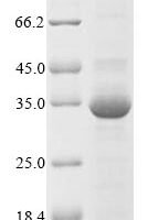 Agkistrodon contortrix contortrix Thrombin-like enzyme contortrixobin Recombinant Protein - BioCrest Sci