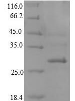 Mouse C-type lectin domain family 4 member K (Cd207),pratial Recombinant Protein - BioCrest Sci