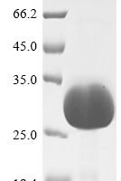 Macaca mulatta Uncharacterized protein (OSM) Recombinant Protein, Tag-Free - BioCrest Sci
