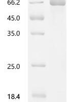 Candida albicans Lanosterol 14-alpha demethylase (ERG11), partial Recombinant Protein - BioCrest Sci