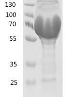 Escherichia coli Colicin-Ia (cia) (626:I→I-GFTFSNYAMSWVRQAPGKGLEWVSSQQYNSYPYT) Recombinant Protein - BioCrest Sci