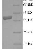 Human 3-hydroxy-3-methylglutaryl-coenzyme A reductase (HMGCR), partial Recombinant Protein, N-His - BioCrest Sci