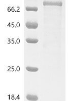 Human Signal-regulatory protein gamma (SIRPG), partial Recombinant Protein, C-hFc1-Flag - BioCrest Sci