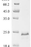 Human TATA-binding protein-associated factor 2N (TAF15), partial Recombinant Protein, N-10His, aa 1–109 - BioCrest Sci