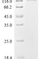 Macaca fascicularis Kallikrein-related peptidase 2 (KLK2) Recombinant Protein, C-10His-HSA - BioCrest Sci