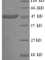 Human ELAV-like protein 3 (ELAVL3) Recombinant Protein, N-His, aa 1–367, E.coli - BioCrest Sci