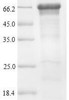 Human Optineurin (OPTN) Recombinant Protein, N-His - BioCrest Sci