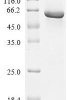Human Tyrosine-protein kinase FRK(FRK) Recombinant Protein - BioCrest Sci