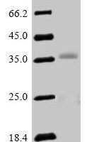 Human Oligodendrocyte transcription factor 2 (OLIG2) Recombinant Protein, N-His - BioCrest Sci