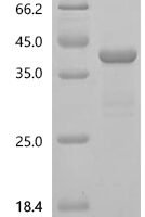 Human Cyclin-dependent kinase 12 (CDK12), partial Recombinant Protein, N-10His - BioCrest Sci