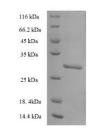 Human Nucleoredoxin-like protein 2 (NXNL2) Recombinant Protein - BioCrest Sci