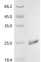 Escherichia coli Superoxide dismutase [Mn] (sodA) Recombinant Protein - BioCrest Sci