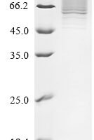 Human Serpin B10 (SERPINB10) Recombinant Protein, N-His-SUMOstar - BioCrest Sci