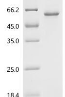 Mouse Thioredoxin-interacting protein (Txnip) Recombinant Protein, C-His - BioCrest Sci
