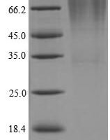 Lysobacter enzymogenes Lysyl endopeptidase Recombinant Protein, N-His - BioCrest Sci
