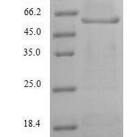 Human Myelin-associated glycoprotein (MAG), partial Recombinant Protein - BioCrest Sci
